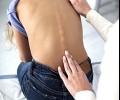 Безплатни прегледи за гръбначни изкривявания и плоскостъпие ще правят Болница „Тракия“ и фирма „РехаБул“